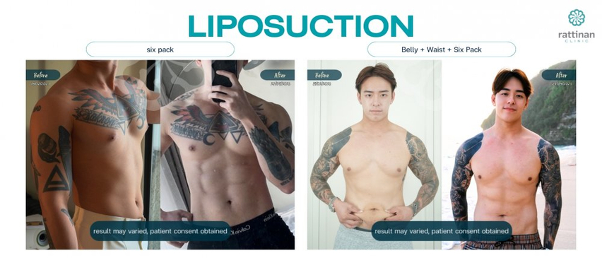 Slider image (2) Calming Confidence in Plastic Surgery at Rattinan Thailand